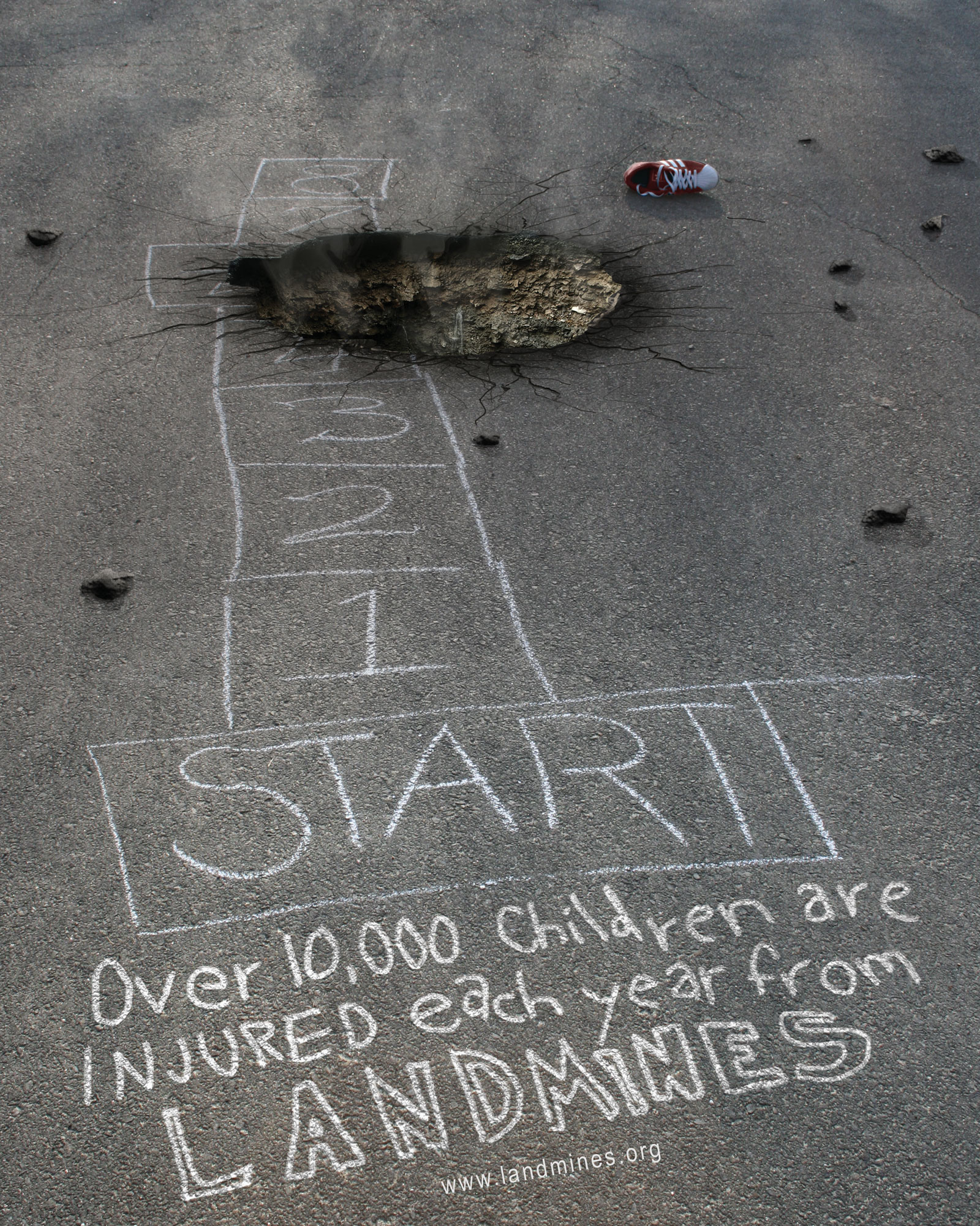Children Injured by Landmines